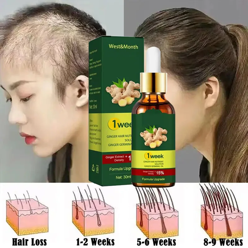 Licorice Root Sticks - เซรั่มปลูกผมขิงสำหรับปลูกผม7วันเซรั่มการเจริญเติบโตของเส้นผมอย่างรวดเร็วป้องกันผมร่วงรักษาหนังศีรษะล้านดูแล Essential น้ำมัน