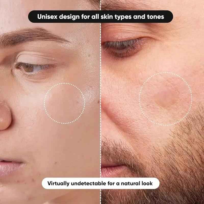 แผ่นแปะสิว 360 ชิ้น/กล่อง - ปร - Essential Oils บทวิจารณ์และราคา